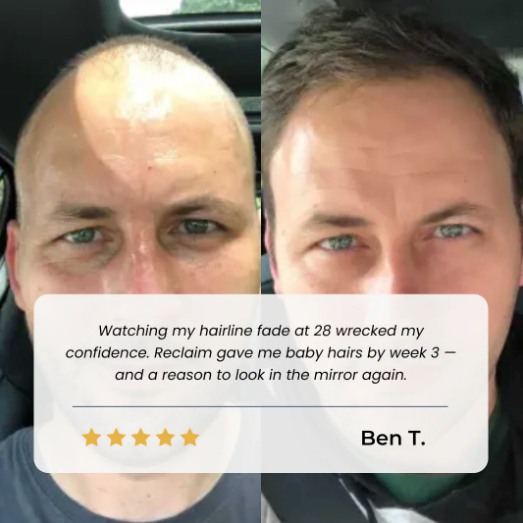 Advanced Hair Growth Roll-On Serum.