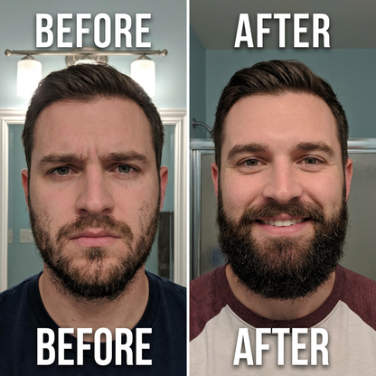 Aparthy Beard Growth Roll on Serum