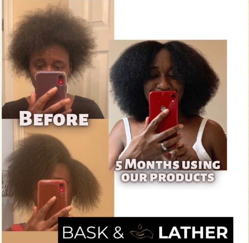 Scalp Stimulator Hair Growth Oil
